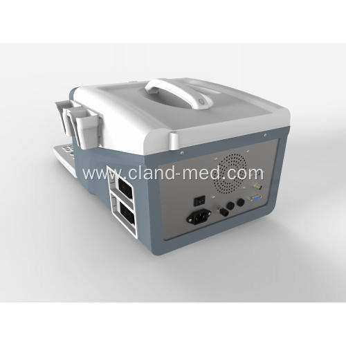 High Resolution Digital Ultrasound Machine